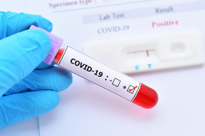Member Of Cabinet Has Tested Positive For Covid-19