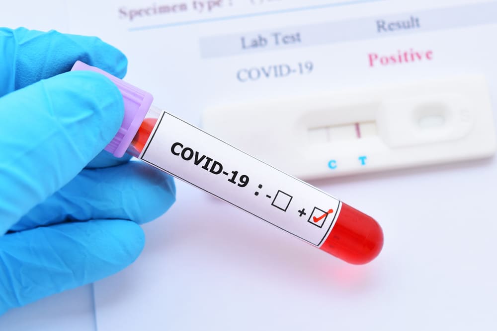 Member Of Cabinet Has Tested Positive For Covid-19